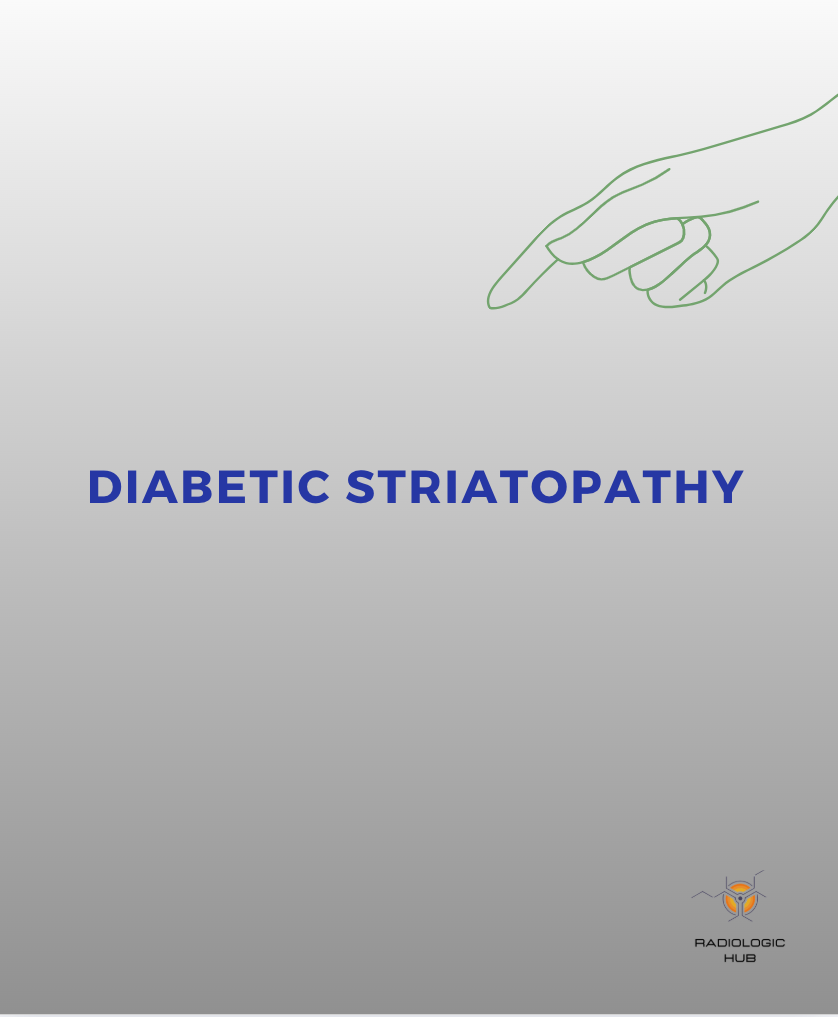 Fiche : striatopathie diabétique